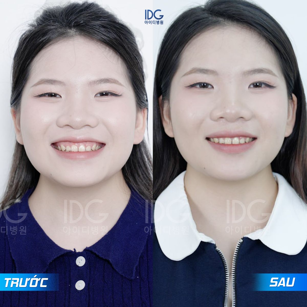 A collage of a person smilingAI-generated content may be incorrect.