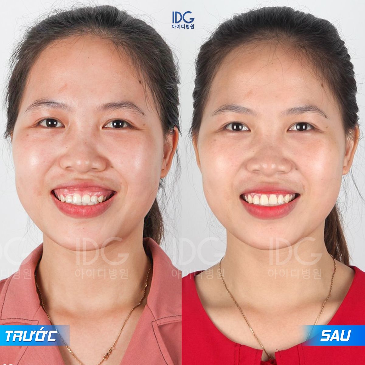 A comparison of a person's faceAI-generated content may be incorrect.